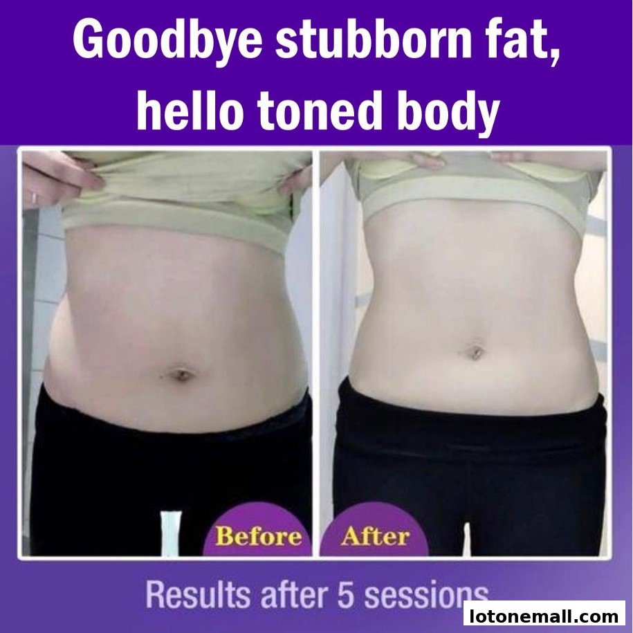 Before and after images showcasing body slimming results after 5 sessions.