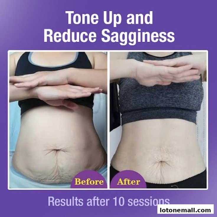 Before and after images showcasing a slimming treatment's effectiveness on the abdomen.
